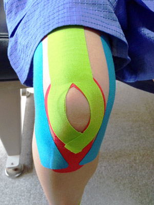 膝のテーピングの画像