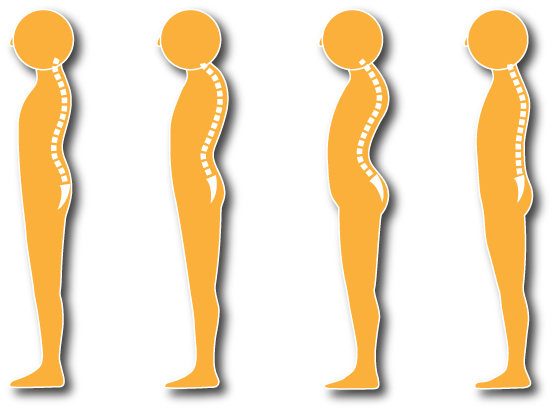 背骨の生理的弯曲を解説する画像